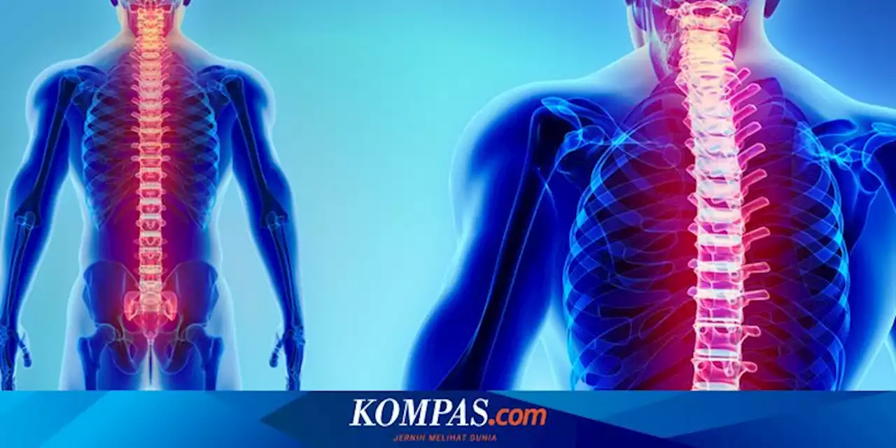 Lordosis: Pengertian, Penyebab, dan Gejala