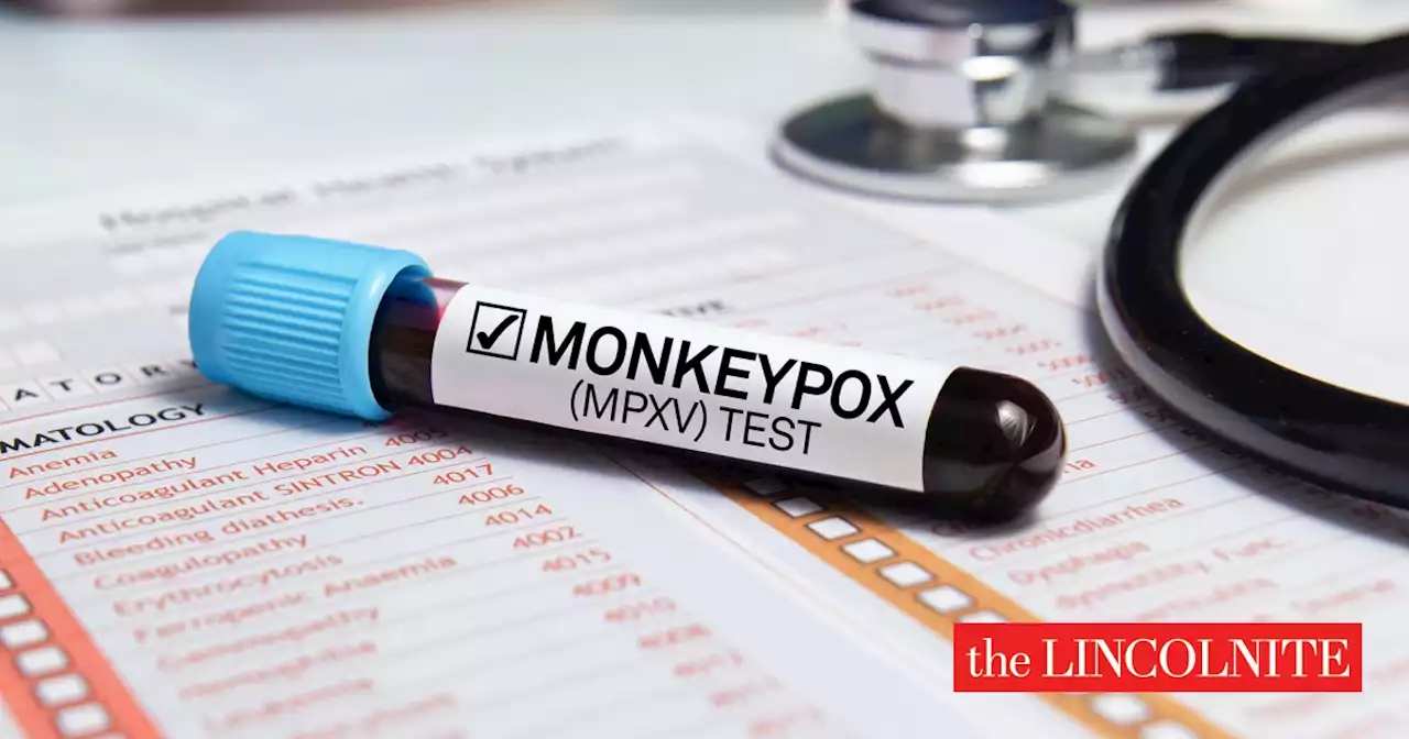 First monkeypox cases confirmed in Lincolnshire and Newark