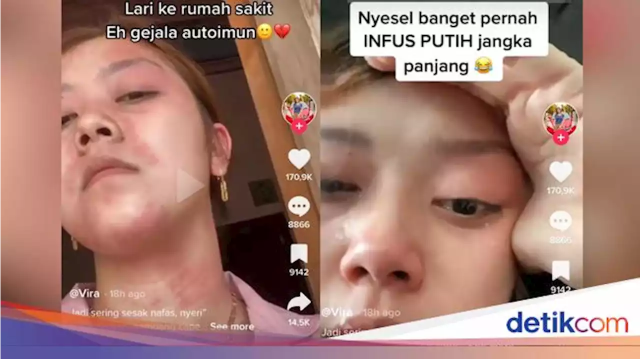 Viral Wanita Jombang Sering Suntik Putih Berakhir Autoimun hingga Sesak Napas