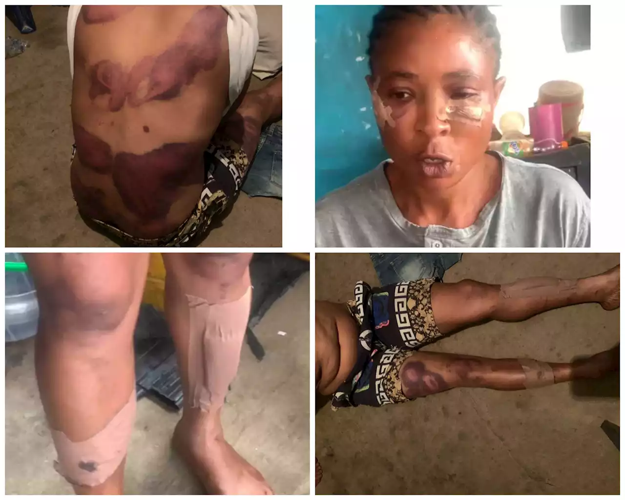 Woman brutalized by Police DPO in Osun