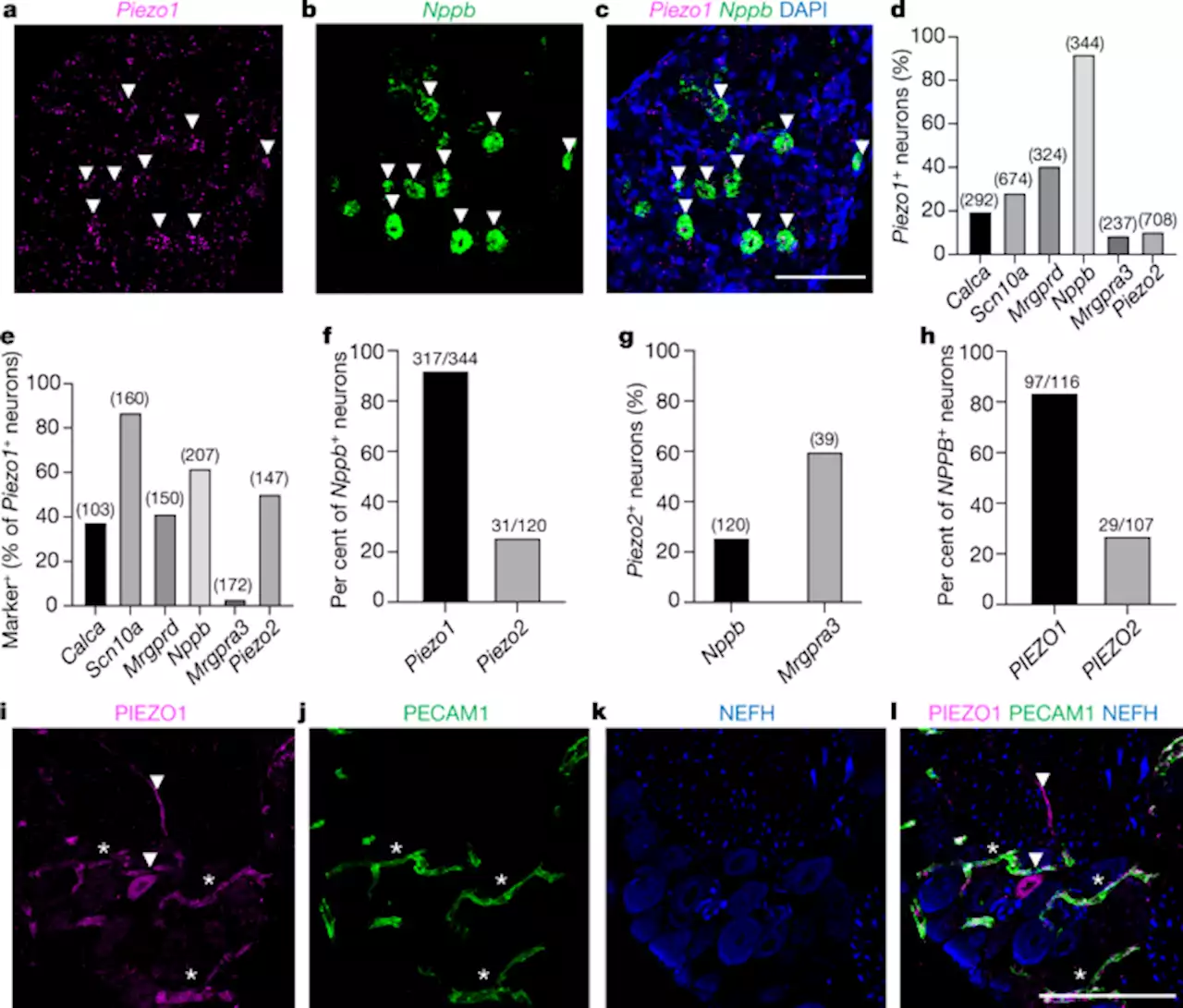 PIEZO1 transduces mechanical itch in mice - Nature