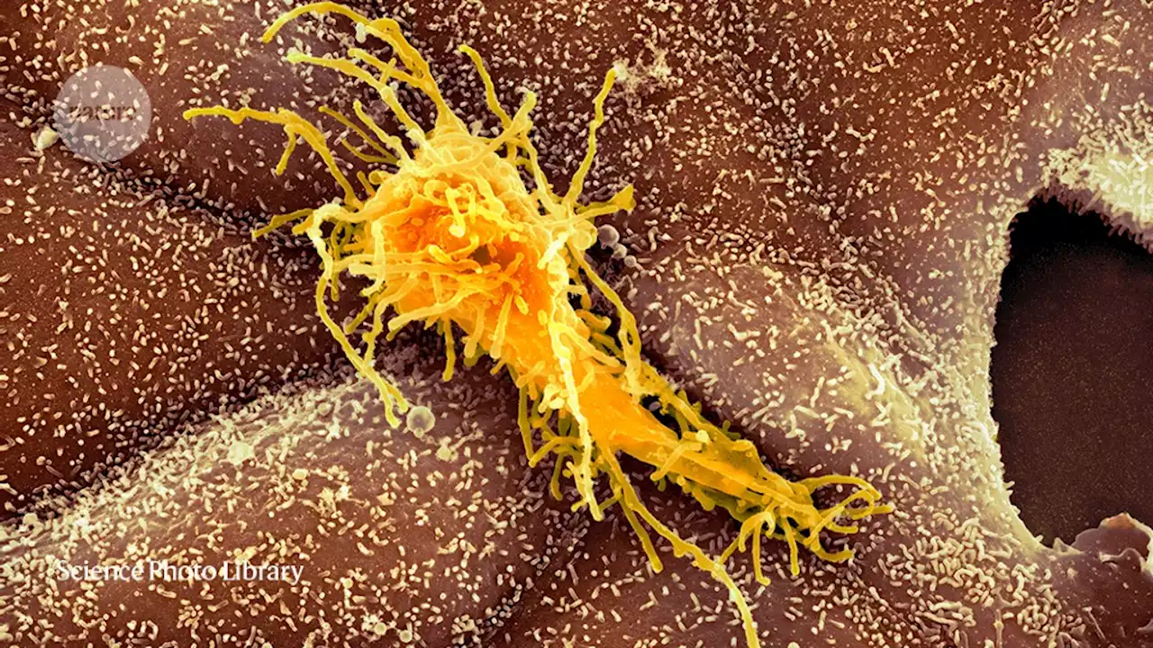 These cancer cells wake up when people sleep