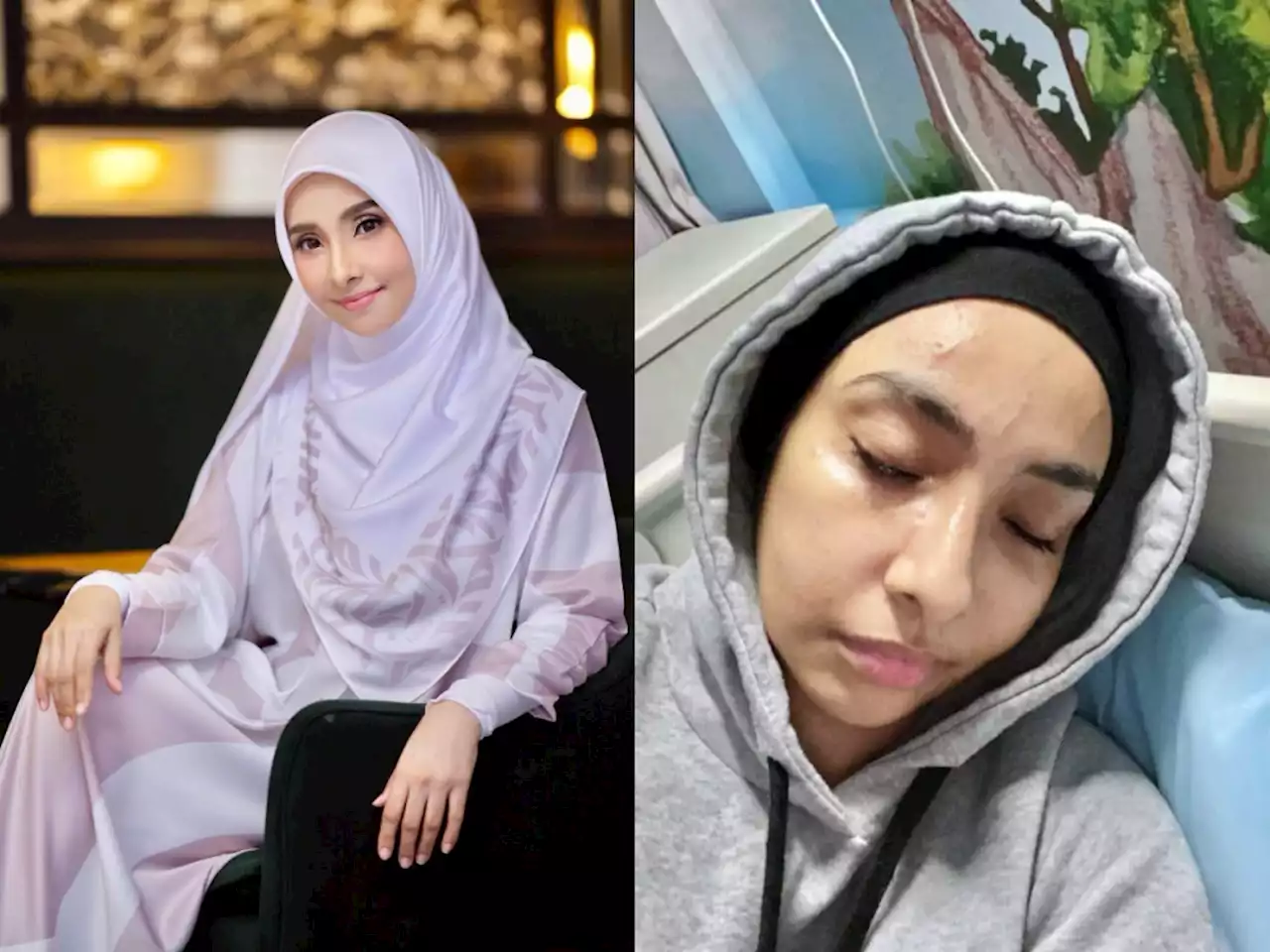 Malaysian actress Lufya Omar injured, claims prevented daughter's kidnap in Kota Damansara