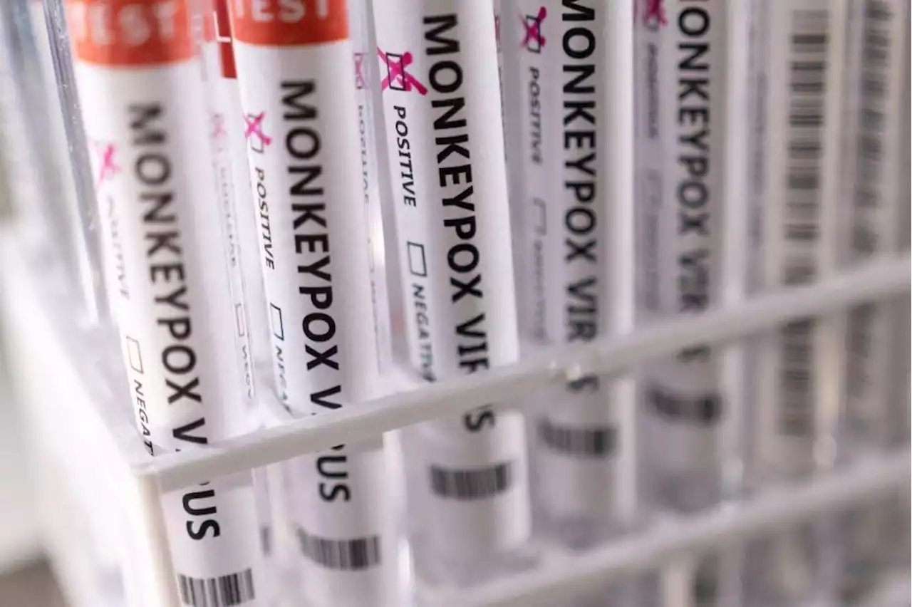 US steps up fight against monkeypox, allocates more vaccines to states