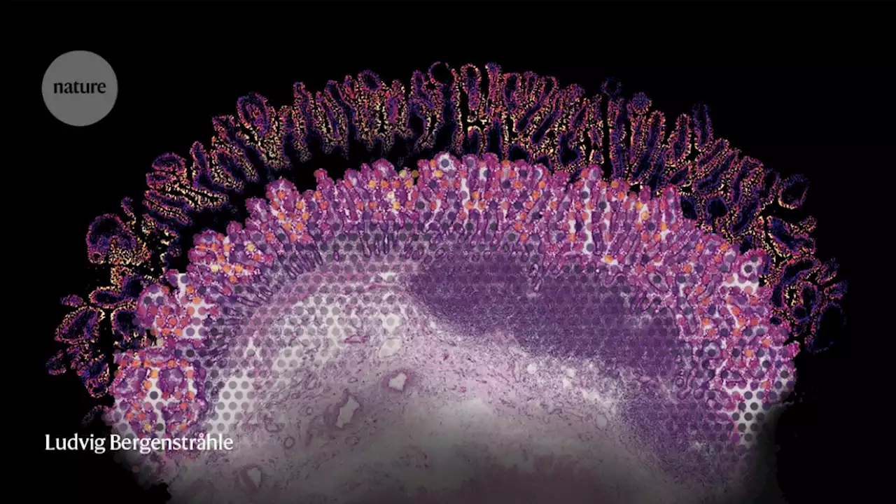 How to make spatial maps of gene activity — down to the cellular level