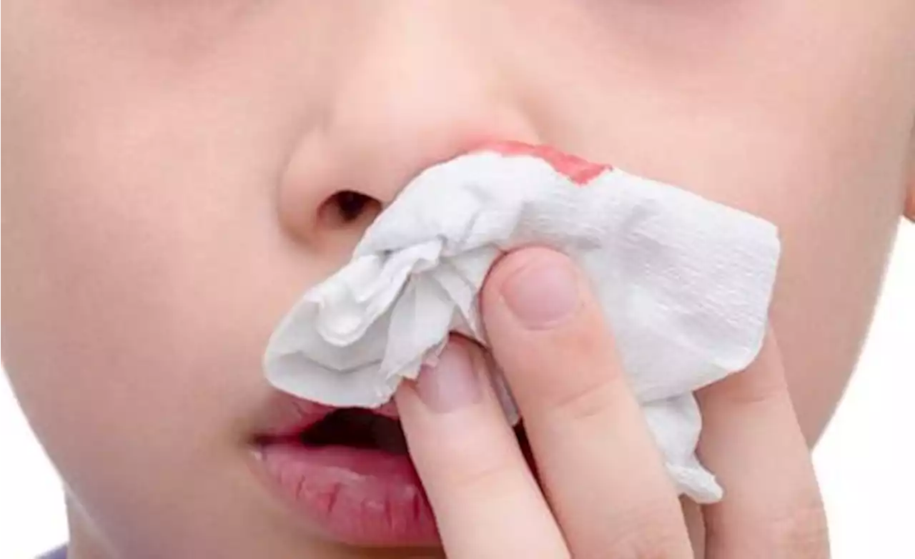 QuickCheck: Should you look up to stop a nosebleed?