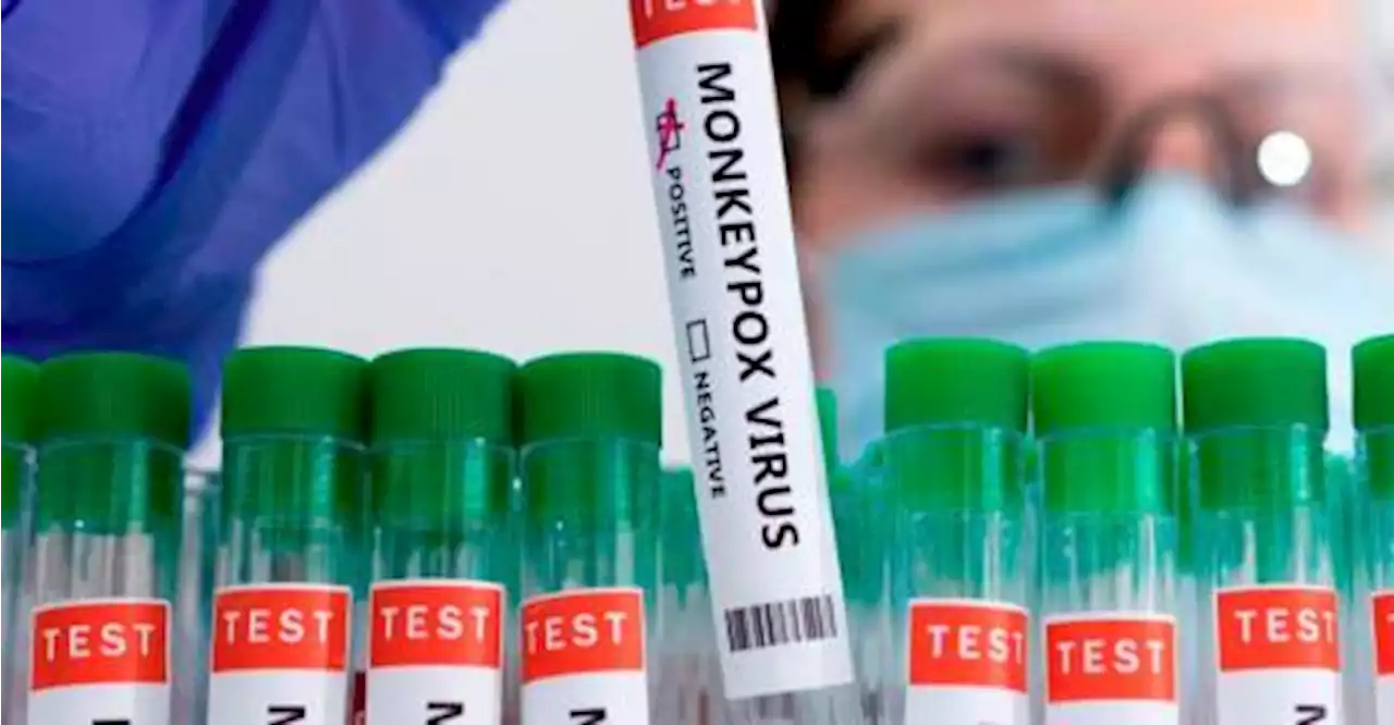 Monkeypox infections in 2022 could be highest in 5 years