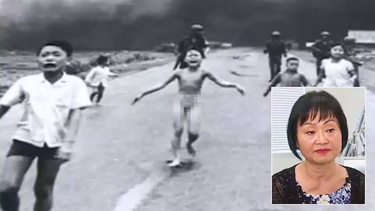 Vietnam ‘Napalm Girl' Gets Final Burn Treatment in Florida 50 Years Later