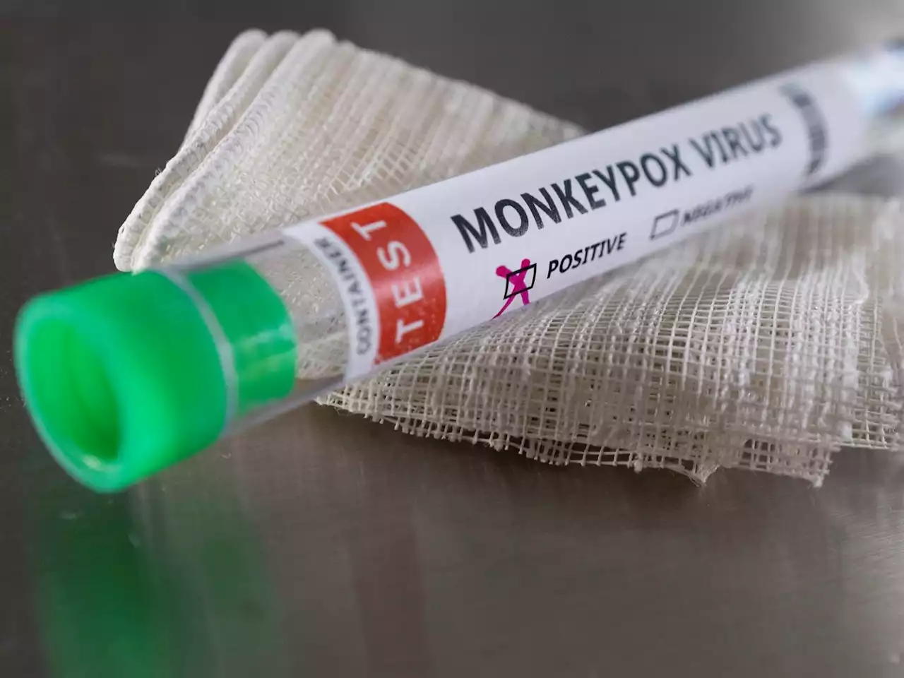 More than 700 monkeypox cases globally, 21 in US - CDC | News24