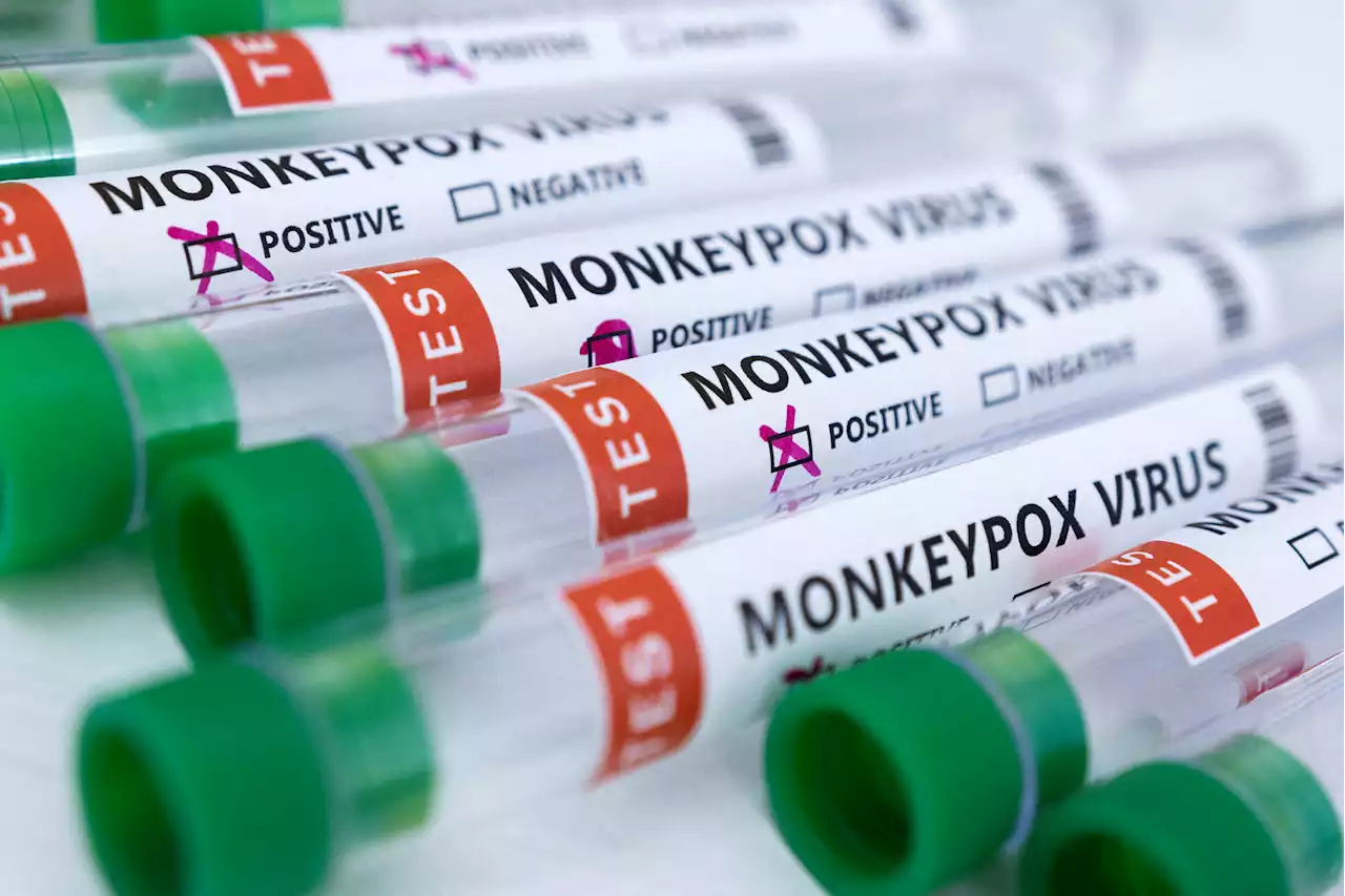 Monkeypox 'may be too late to contain & will be hard to stamp out', say experts