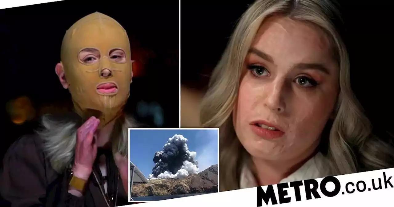 Survivor of volcanic eruption removes her compression mask for first time