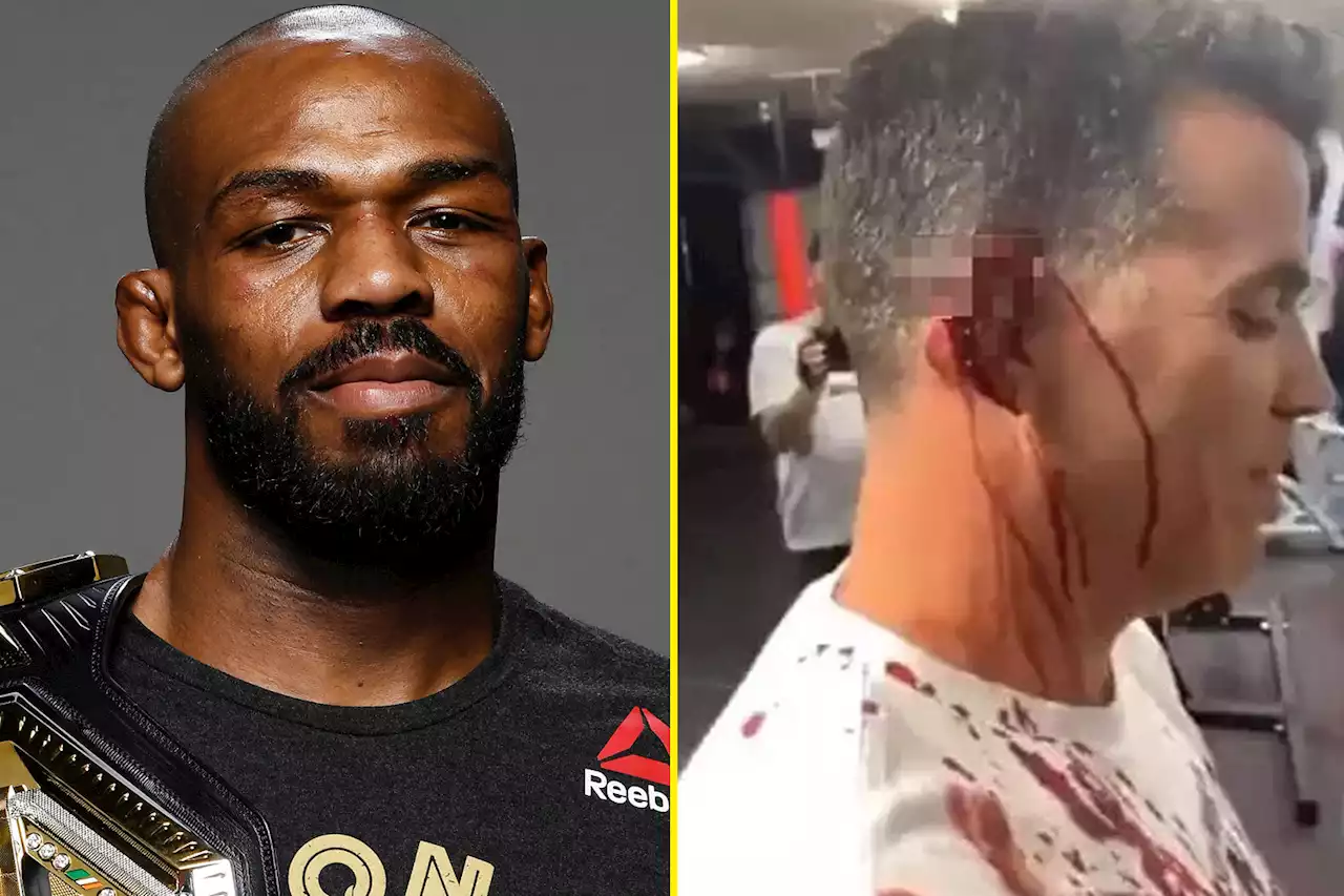 Jon Jones chopped off a piece Jackass Star Steve-O’s ear after stunt went wrong