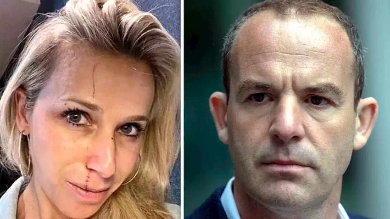 Martin Lewis sparks concern with health update after wife's accident ‘Feeling cr*p!’