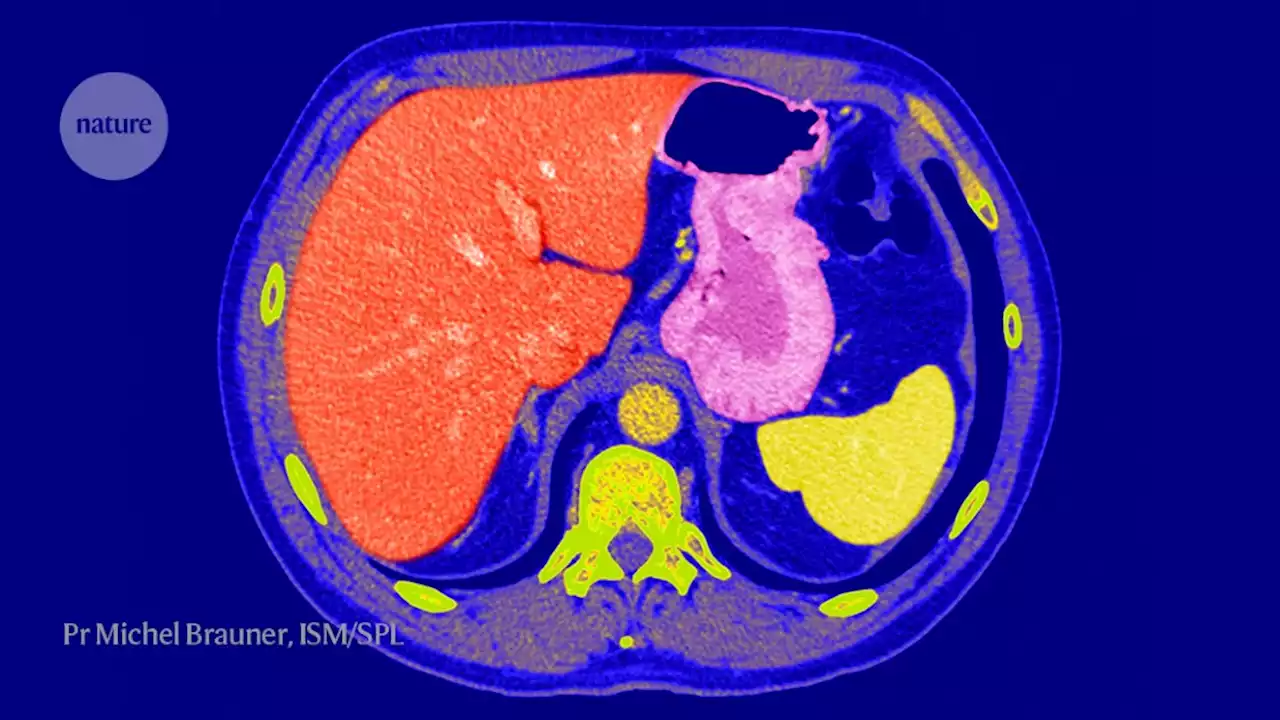 How a full gut tells the mouth to stop eating