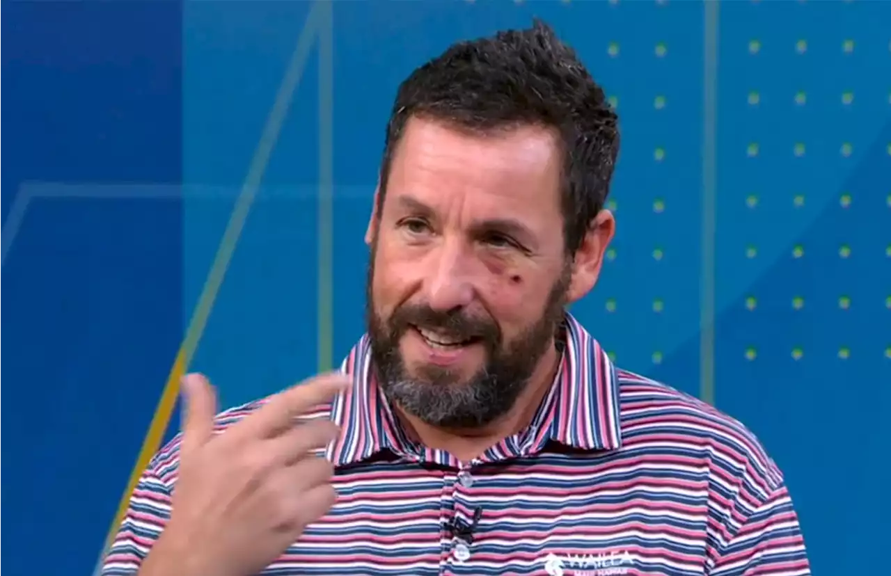 Adam Sandler appears on ‘GMA’ with black eye after ‘bad accident’