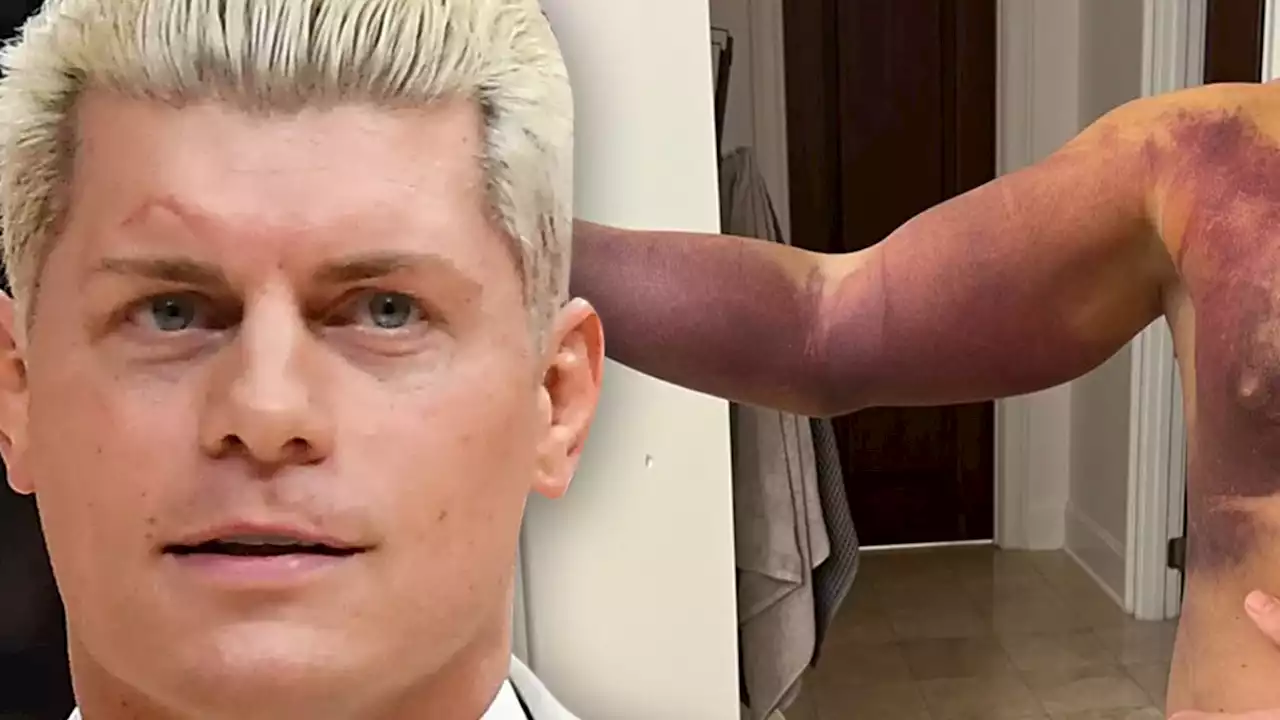 WWE's Cody Rhodes Shows Off Gruesome Pec Injury Days After 'Hell In A Cell' Match