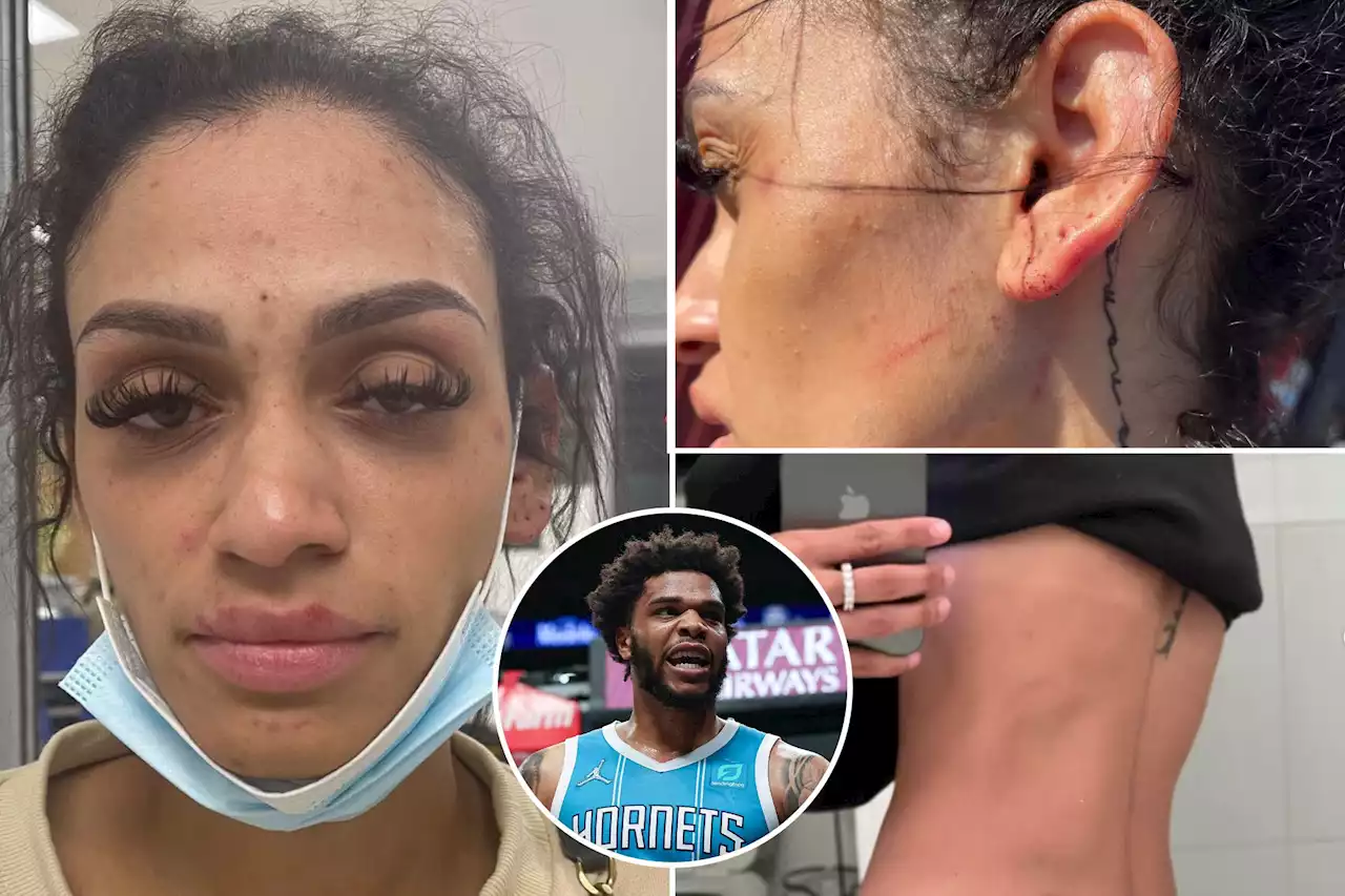 Wife of Hornets’ player Miles Bridges shares photos of alleged attack: ‘Can’t be silent anymore’