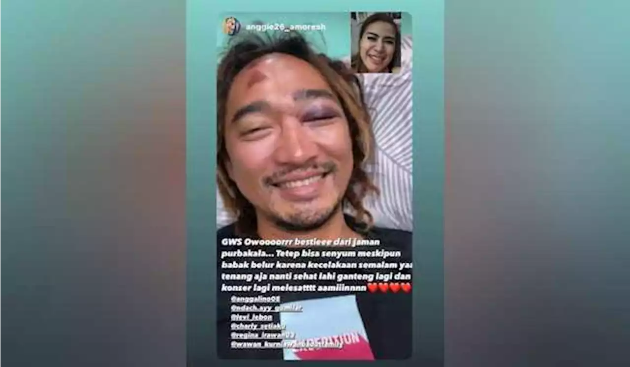 Kecelakaan di Jalan Tol, Charly Van Houten Selamat