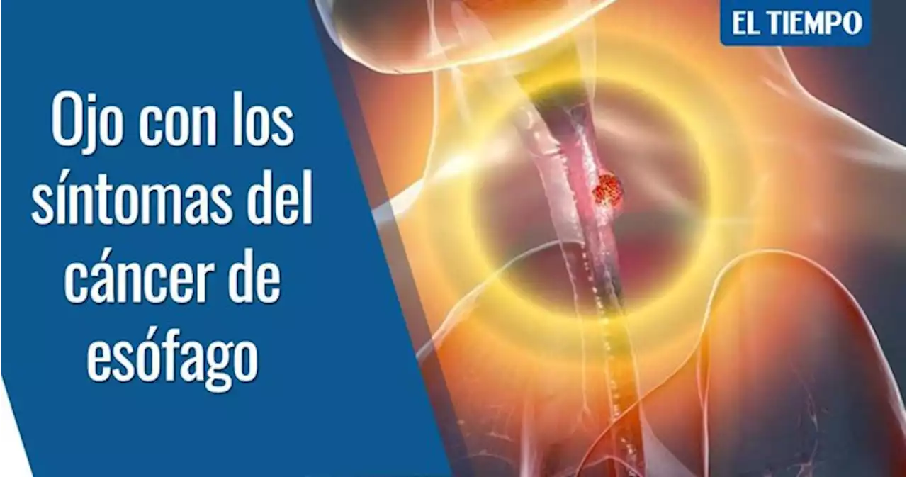 Cuáles son los síntomas del cáncer de esófago y por qué no ignorarlos