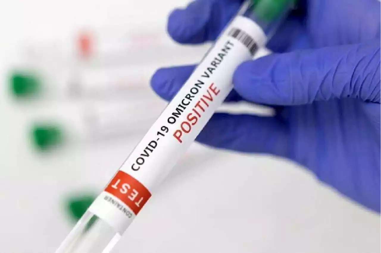 New Covid-19 cases rise to 208 in Sabah, says state minister
