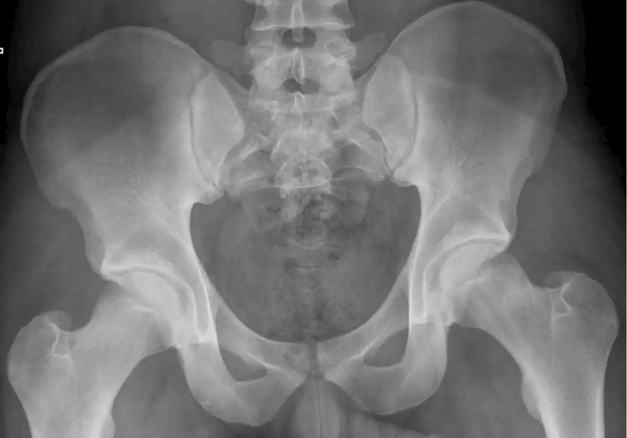 Cycling can make your bones brittle; here's how to stop it