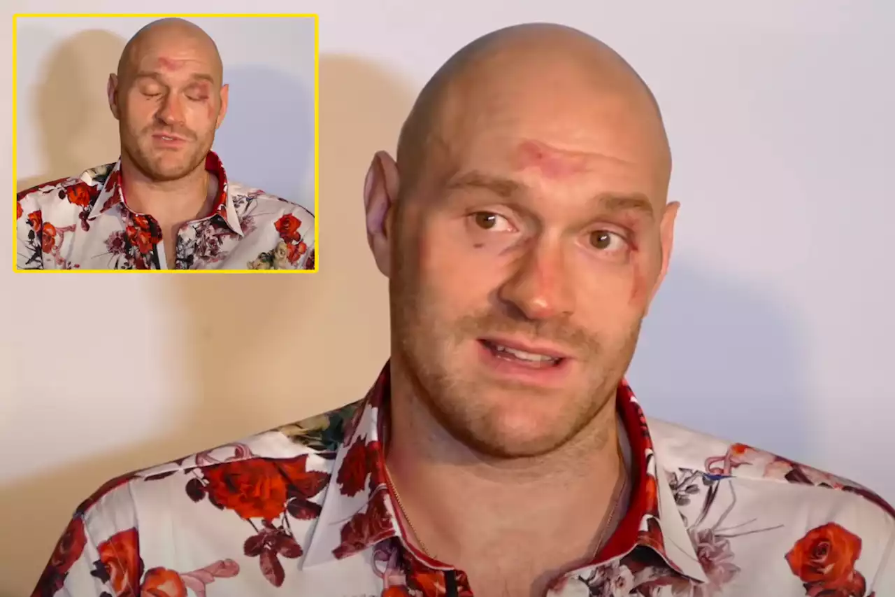 Tyson Fury had concussion, 'massive swelling' and feared brain damage after Deontay Wilder fight