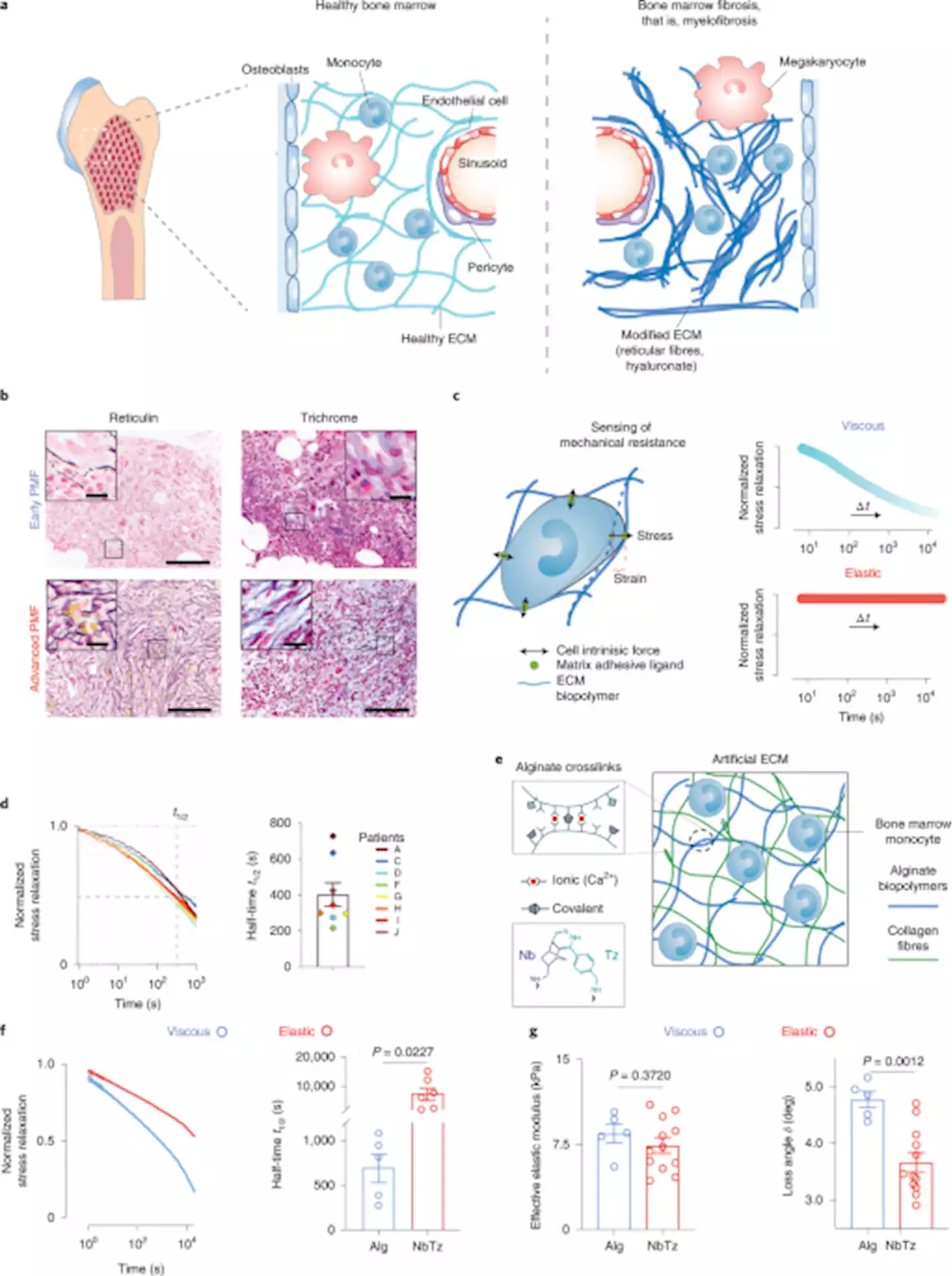 Mechanical checkpoint regulates monocyte differentiation in fibrotic niches - Nature Materials