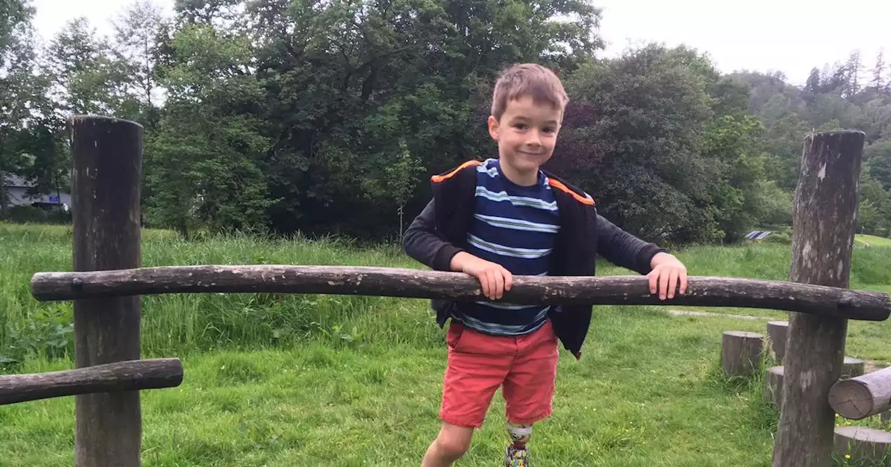 Brave boy born with one leg half the size of other beats odds with 'robot limb'