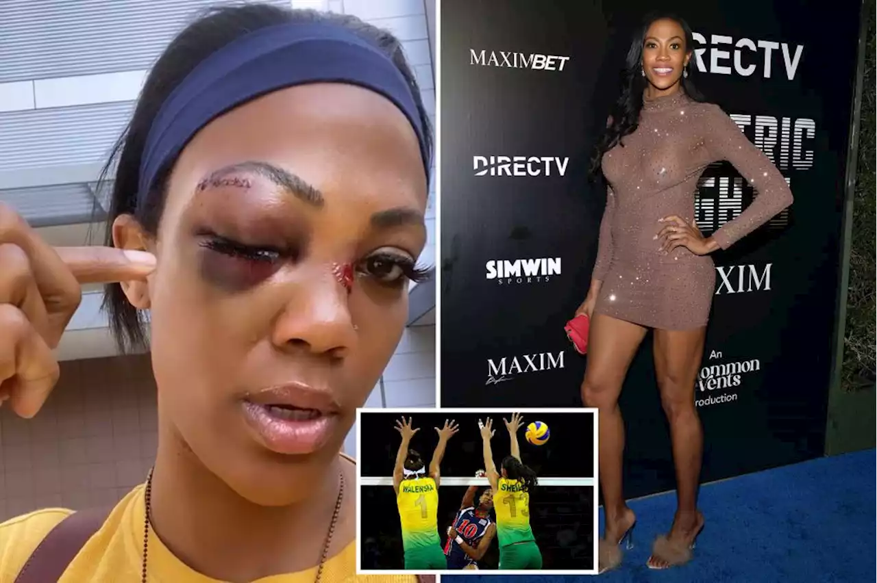 Olympian Kim Glass reveals homeless man nearly blinded her in attack in LA