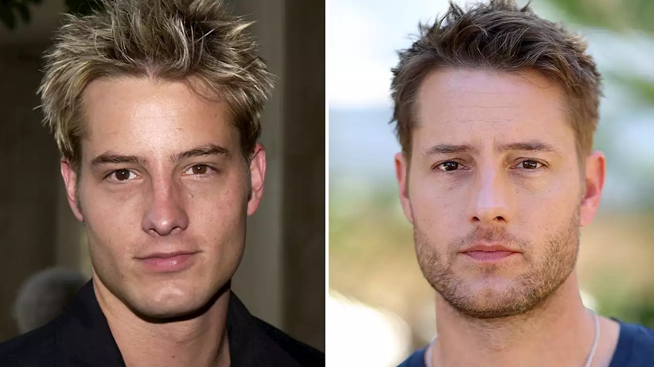 Justin Hartley -- Good Genes or Good Docs?!