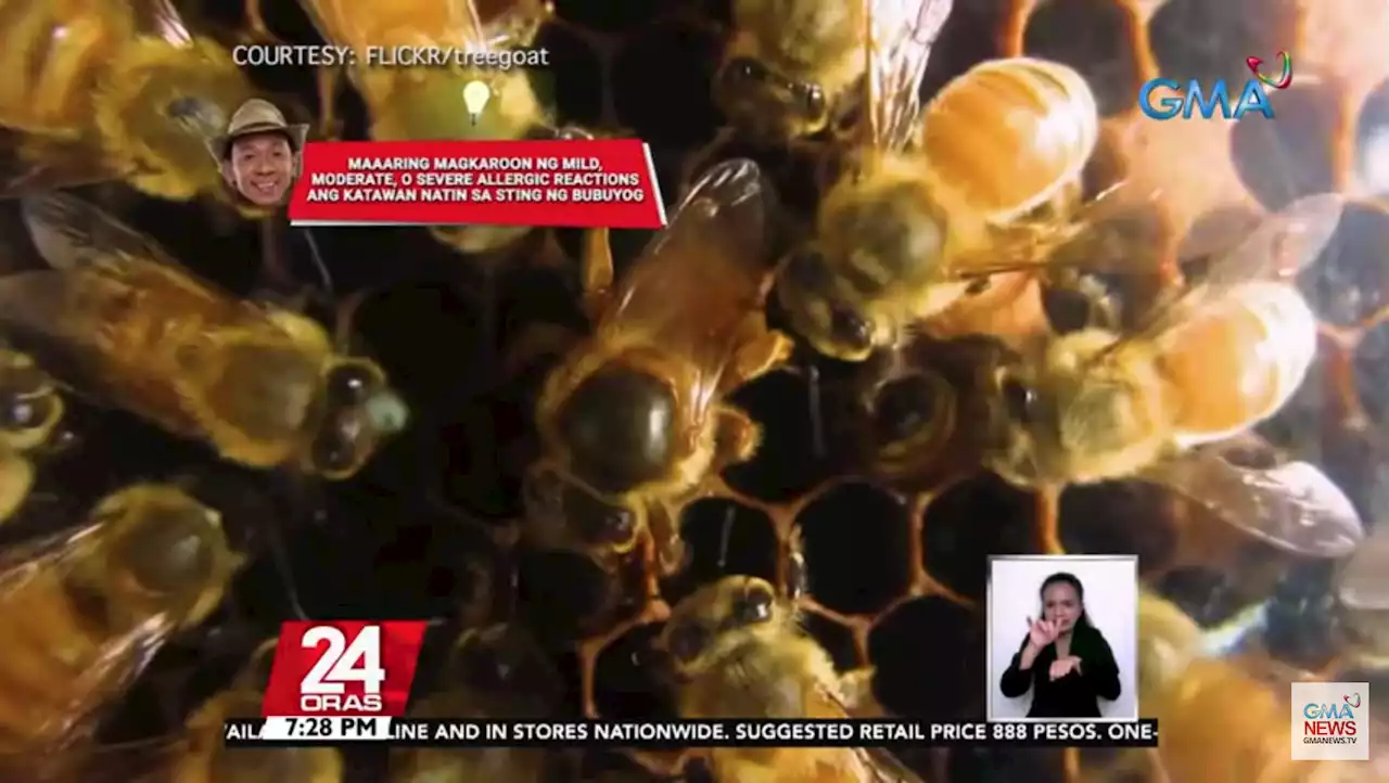 What to do when you get a bee sting? Kuya Kim explains