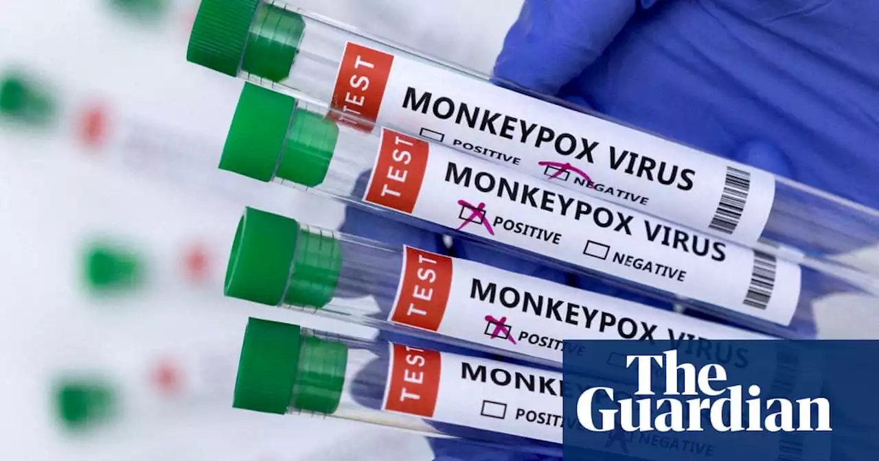New Zealand reports second monkeypox case, unrelated to first