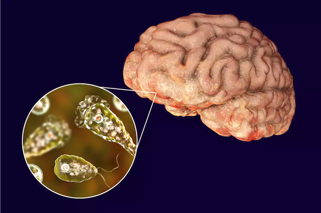 5 things to know about the brain-eating amoeba that infected a swimmer in Iowa