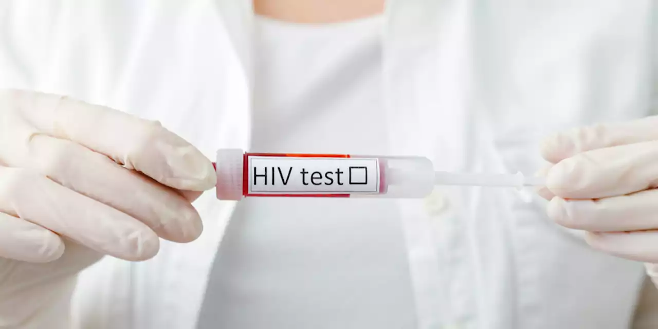 HIV Screening: What to Know