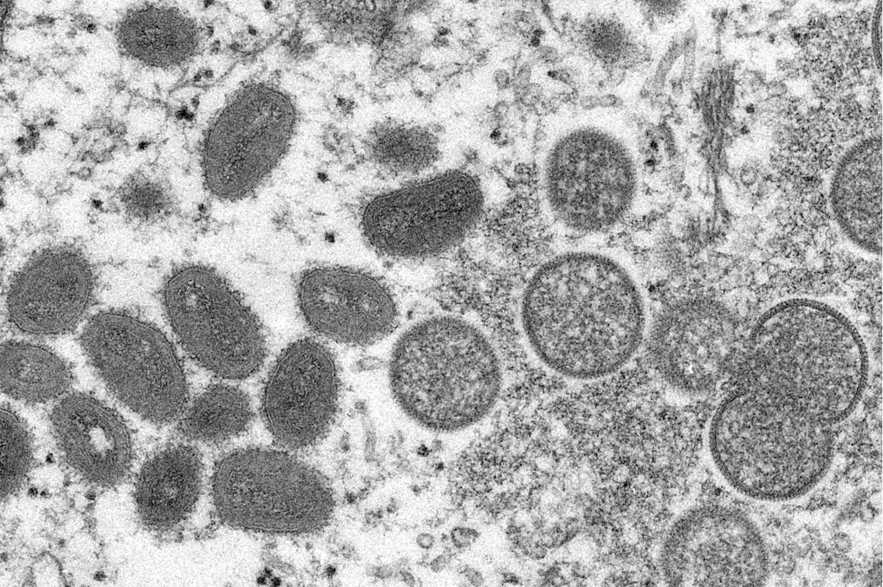 What You Need to Know About the Monkeypox Outbreak | The Brian Lehrer Show | WNYC