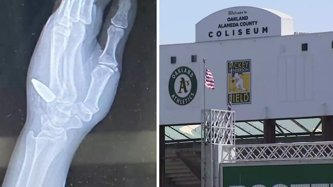 EXCLUSIVE: East Bay man says daughter hit by full bullet, not 'fragment' at Oakland A's game