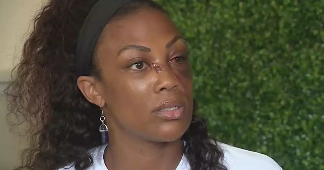 'Rage in his eyes': Former Olympian Kim Glass recovering from attack by homeless man in downtown LA