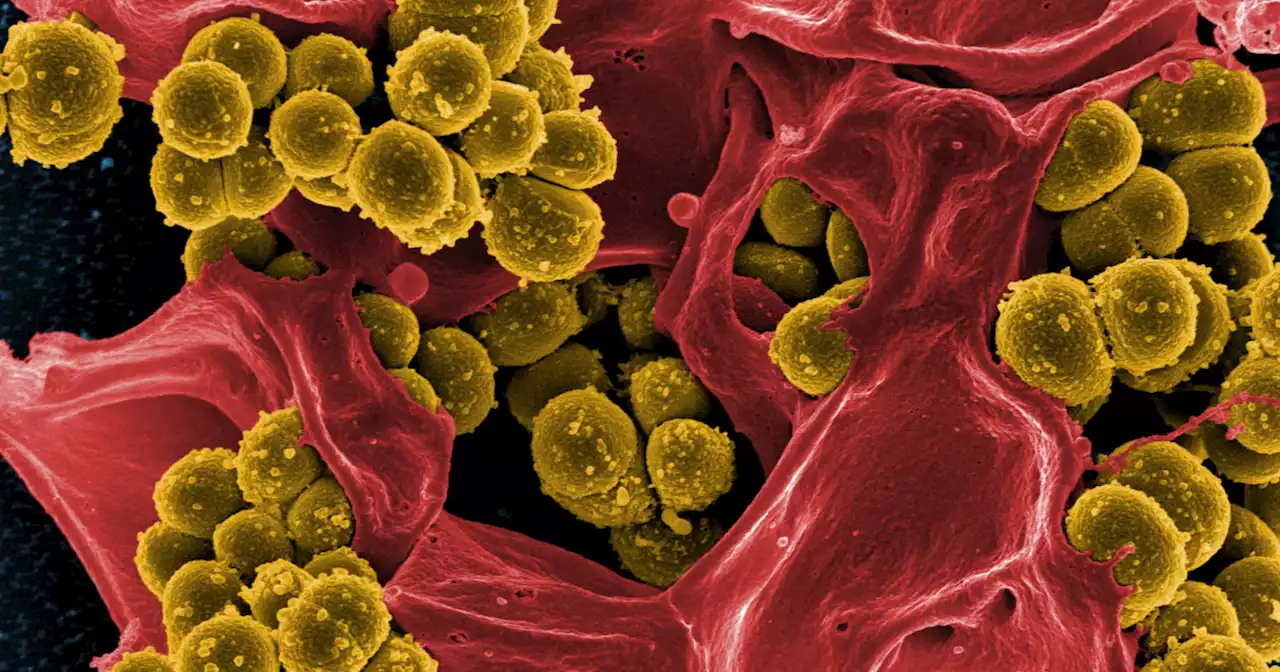 Superbug infections spiked in pandemic's first wave