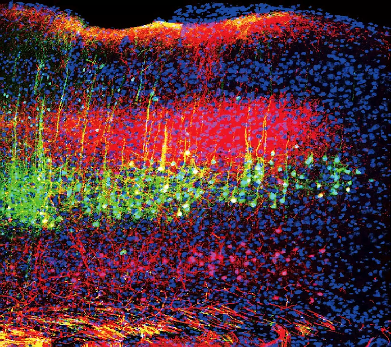 Chronic Pain Relief Through Sound: Newly Identified Brain Circuits May Point to Better Pain Therapies