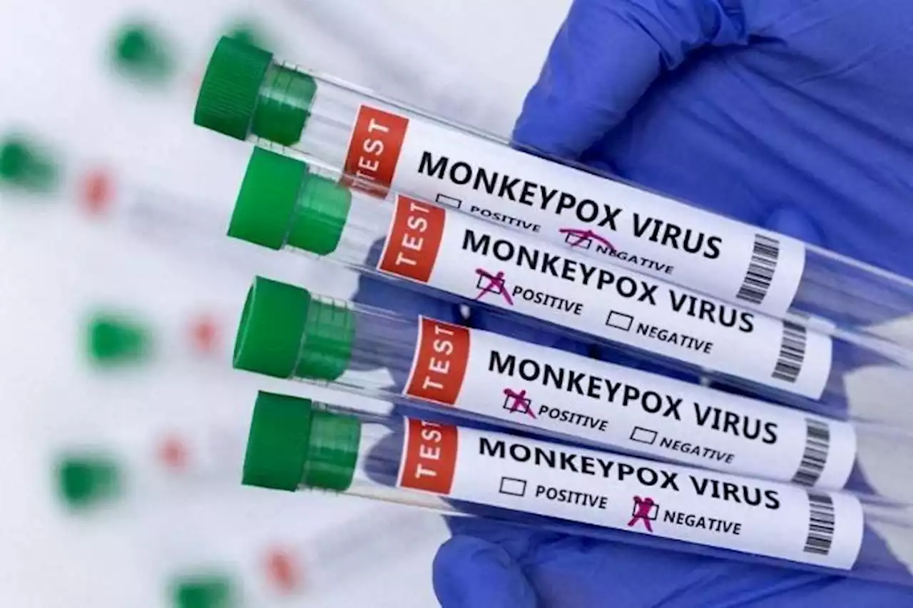 Singapore records second local monkeypox case