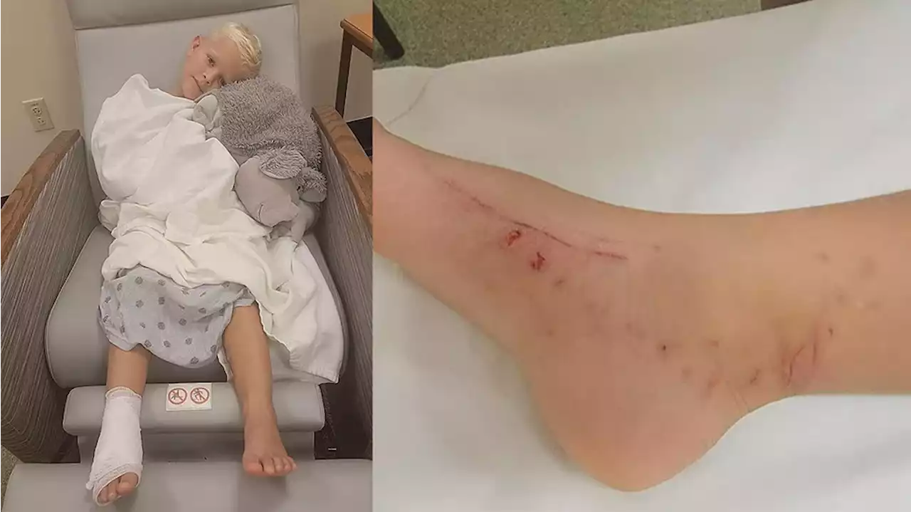 6-year-old boy recovering from alligator bite