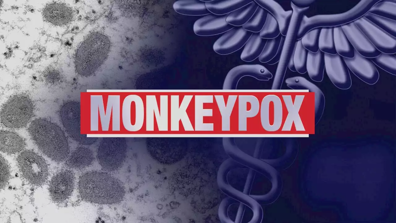 First case of monkeypox reported in Alabama - Alabama News