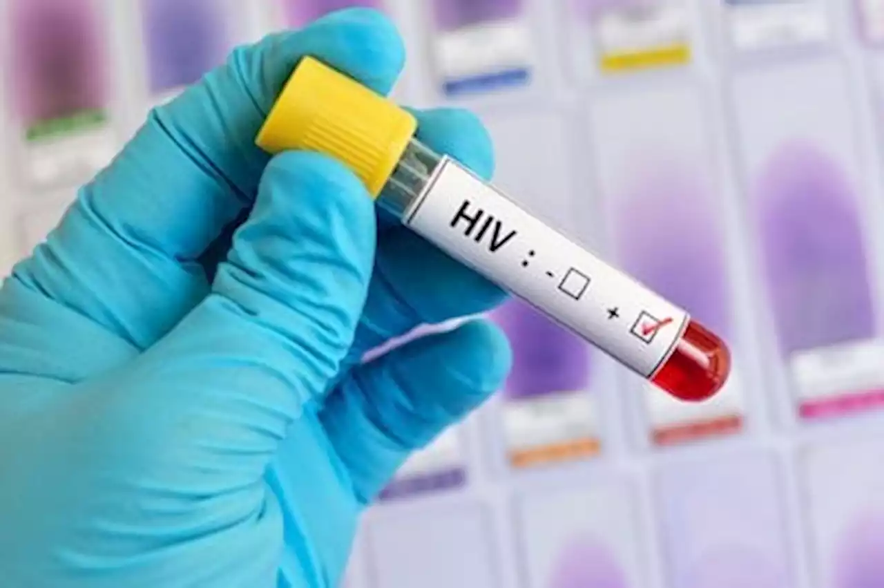 KZN’s HIV infection rate in the spotlight