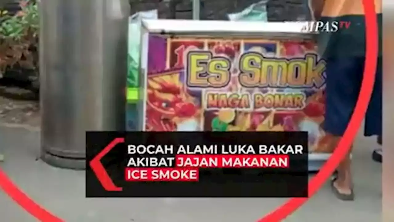 Bocah Terbakar Usai Makan Jajanan Viral Ice Smoke, Luka Bakar di Wajah hingga Tangan