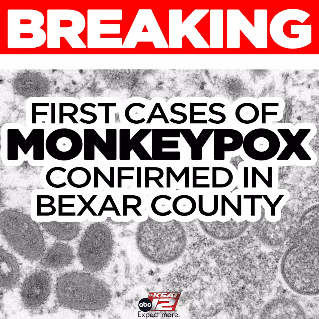 First cases of monkeypox confirmed in Bexar County, Metro Health says