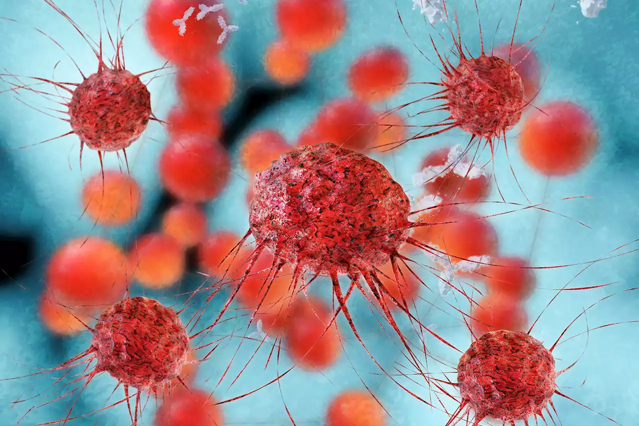 A New, High-Risk Subtype of Cancer Has Been Discovered