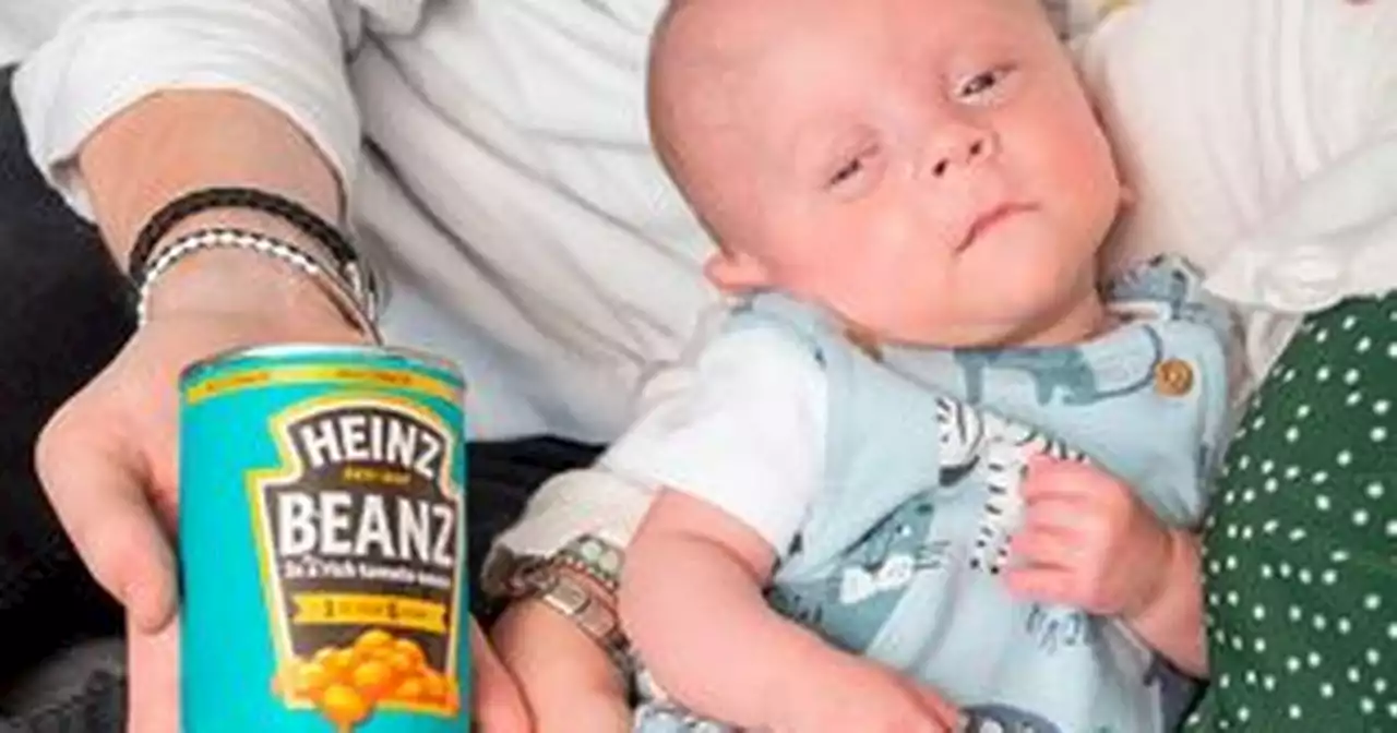 'Miracle' baby born so small he weighed less than a tin of beans