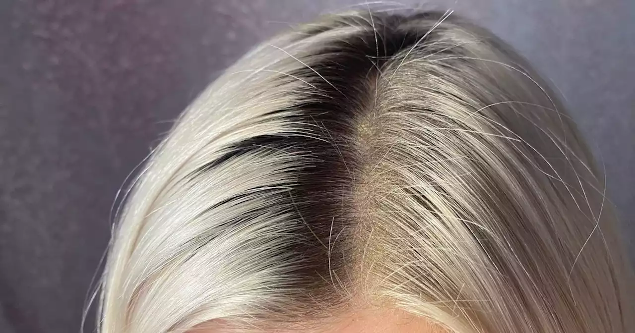 I tried to hide my roots with a £29 product and got mixed results