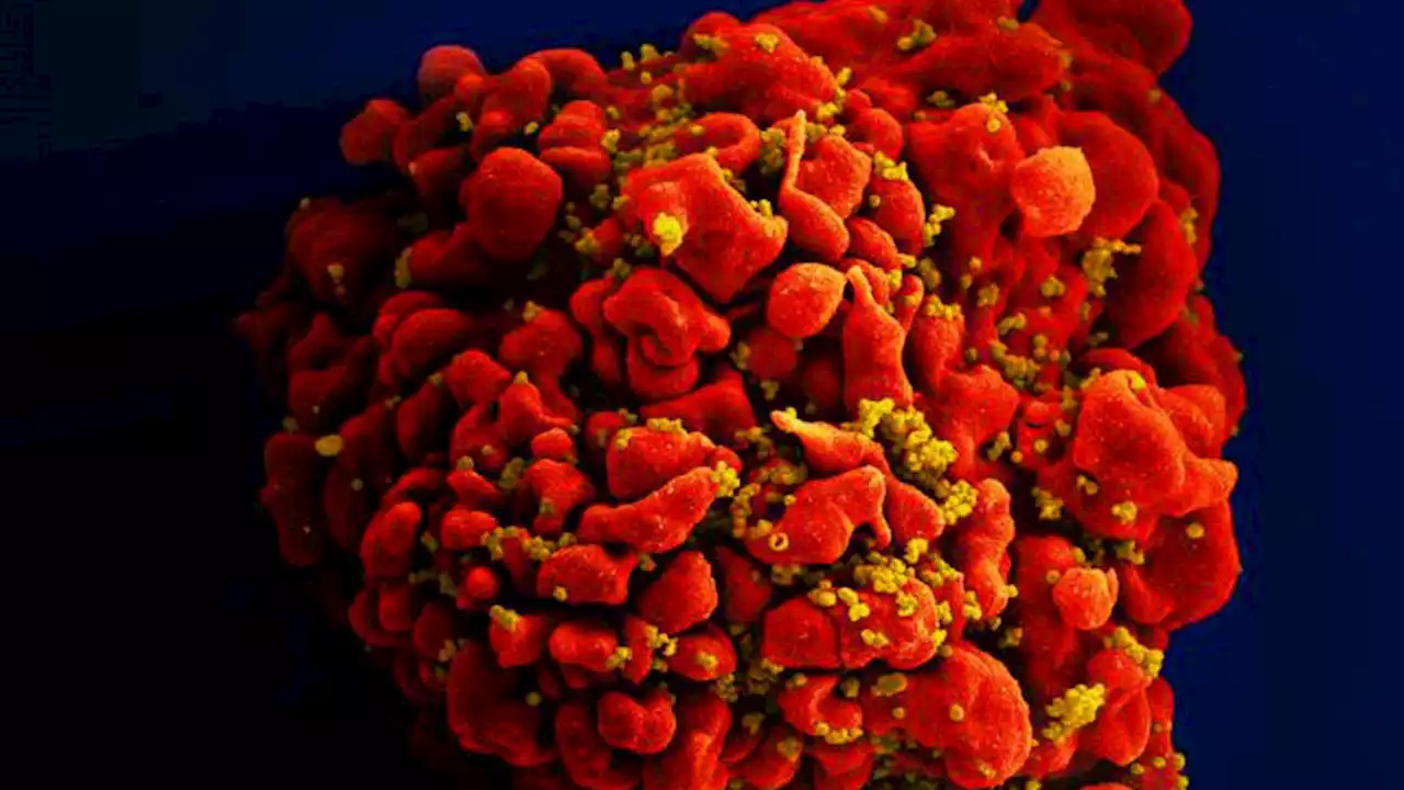 'Substantial': HIV may accelerate aging significantly in infected people