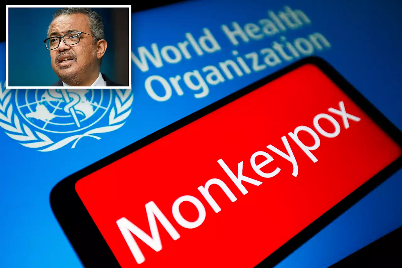 WHO: Monkeypox not a serious threat at the moment